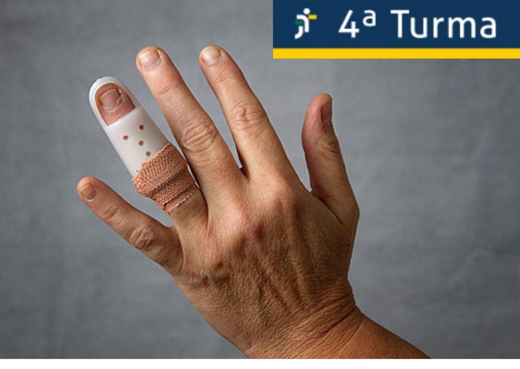 Pousada é condenada em danos morais após funcionária fraturar dedo em